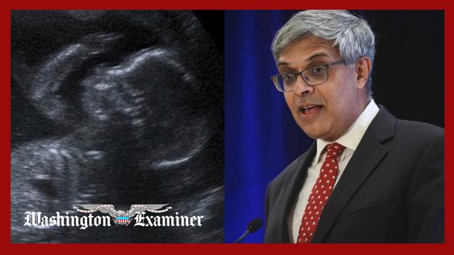 Trump ends funding for research using aborted baby tissue